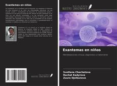 Couverture de Exantemas en niños