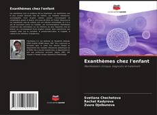 Exanthèmes chez l'enfant的封面