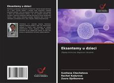 Eksantemy u dzieci的封面