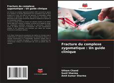 Bookcover of Fracture du complexe zygomatique : Un guide clinique