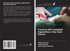 Обложка Fractura Del Complejo Cigomático: Una Guía Clínica