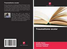 Bookcover of Traumatismo ocular