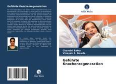 Buchcover von Geführte Knochenregeneration