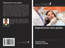 Copertina di Regeneración ósea guiada