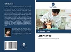 Bookcover of Zahnkaries