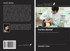Copertina di Caries dental