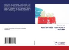 Copertina di Resin Bonded Fixed Partial Dentures