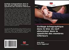 Bookcover of Guidage échographique dans le bloc du nerf obturateur dans la spasticité des membres inférieurs