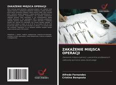 Copertina di ZAKAŻENIE MIEJSCA OPERACJI