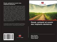Copertina di Passé, présent et avenir des implants dentaires