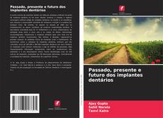 Bookcover of Passado, presente e futuro dos implantes dentários