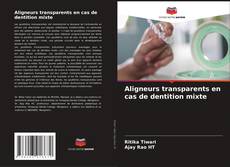 Обложка Aligneurs transparents en cas de dentition mixte