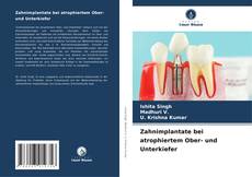 Portada del libro de Zahnimplantate bei atrophiertem Ober- und Unterkiefer