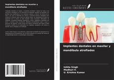 Capa do livro de Implantes dentales en maxilar y mandíbula atrofiados 