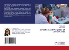 Buchcover von Detection and Diagnosis of Dental Caries