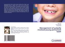 Buchcover von Management of pulpally involved young permanent teeth