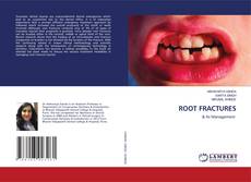 Bookcover of ROOT FRACTURES