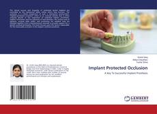 Buchcover von Implant Protected Occlusion