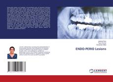 Copertina di ENDO-PERIO Lesions