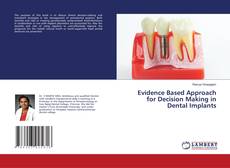 Copertina di Evidence Based Approach for Decision Making in Dental Implants