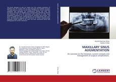 Copertina di MAXILLARY SINUS AUGMENTATION