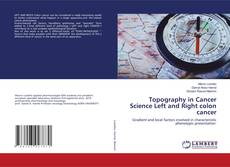 Buchcover von Topography in Cancer Science Left and Right colon cancer