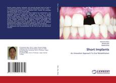 Copertina di Short Implants