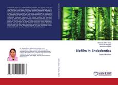 Bookcover of Biofilm in Endodontics