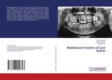 Radiolucent lesions of jaw bones的封面