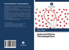 Обложка Geburtshilfliche Thrombophilien