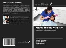 Bookcover of PERIODONTITIS AGRESIVA