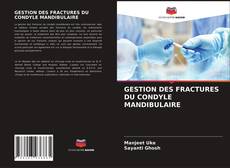 Copertina di GESTION DES FRACTURES DU CONDYLE MANDIBULAIRE