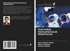 Portada del libro de FRACTURAS MAXILOFACIALES PEDIÁTRICAS