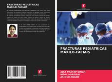 Bookcover of FRACTURAS PEDIÁTRICAS MAXILO-FACIAIS