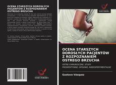 Bookcover of OCENA STARSZYCH DOROSŁYCH PACJENTÓW Z ROZPOZNANIEM OSTREGO BRZUCHA