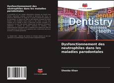 Couverture de Dysfonctionnement des neutrophiles dans les maladies parodontales