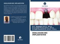 Buchcover von OKKLUSION BEI IMPLANTATEN