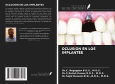 Bookcover of OCLUSIÓN EN LOS IMPLANTES