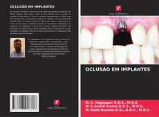 Buchcover von OCLUSÃO EM IMPLANTES