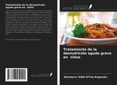 Bookcover of Tratamiento de la desnutrición aguda grave en niños