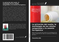 Bookcover of La privación del sueño, la morfología de las células sanguíneas y la anemia ferropénica