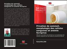 Privation de sommeil, morphologie des cellules sanguines et anémie ferriprive kitap kapağı