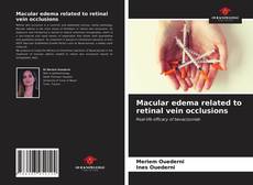 Buchcover von Macular edema related to retinal vein occlusions
