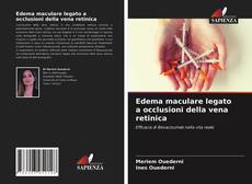 Copertina di Edema maculare legato a occlusioni della vena retinica