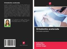 Обложка Ortodontia acelerada