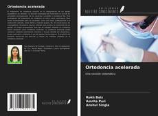 Portada del libro de Ortodoncia acelerada