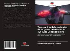Buchcover von Tumeur à cellules géantes de la gaine du tendon et synovite vellonodulaire