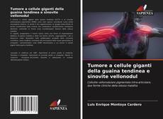 Tumore a cellule giganti della guaina tendinea e sinovite vellonodul kitap kapağı