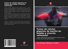 Portada del libro de Tumor de células gigantes da bainha do tendão e sinovite vellonodul