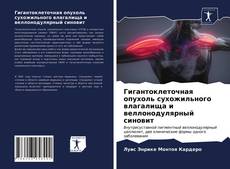 Bookcover of Гигантоклеточная опухоль сухожильного влагалища и веллонодулярный синовит